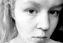 La morte non è cura, ma il mondo ormai è malattia noa