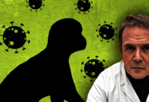 La clamorosa scoperta del Dott. Barbaro ▷ “Vaiolo delle scimmie? Tutti casi di Herpes Zoster post-farmaco”