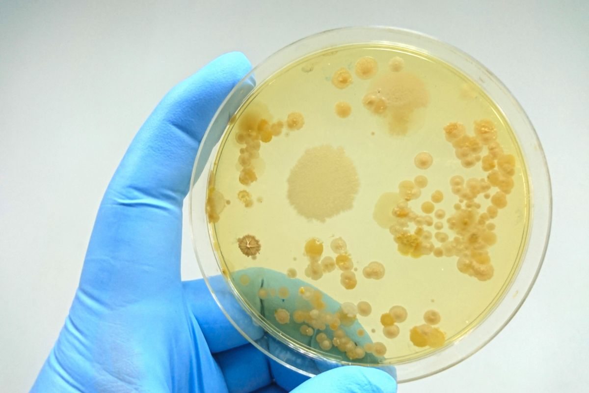 vetrino con colonia di batteri