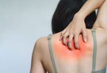 donna che si gratta dietro la schiena