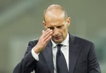 Massimiliano Allegri contrariato