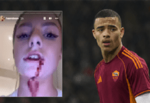 Greenwood-Roma, c’è chi dice no! Biotti: “Imperdonabile!